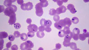 Una mutación amenaza el tratamiento más usado contra la malaria